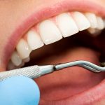 دستیار دندانپزشک مقدماتی (300 ساعت عملی و تئوری بمدت 3 ماه)